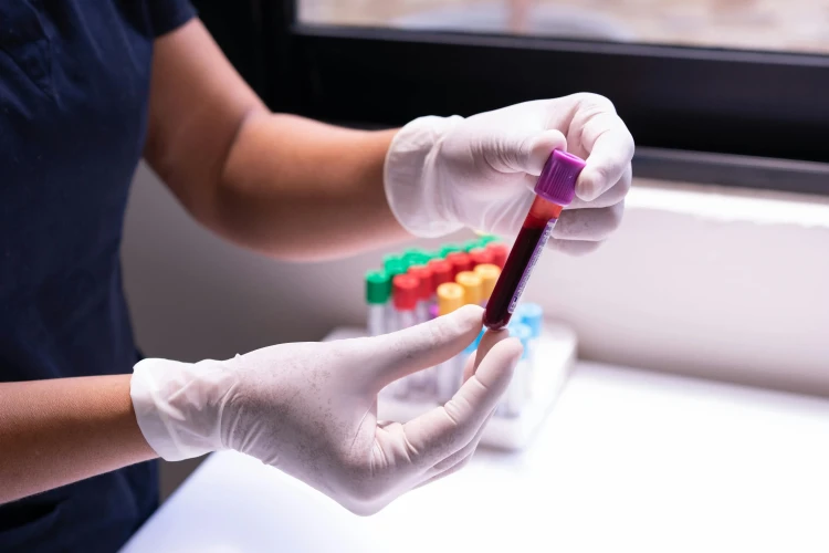 Laboratorium Synevo analizuje próbki krwi.webp