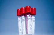 Probówki z próbkami krwi do analizy laboratoryjnej.webp