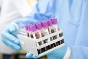 probowki-do-badan-laboratoryjnych.webp