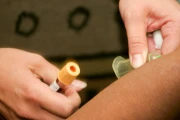 Pobieranie próbki krwi do badań laboratoryjnych.webp