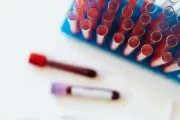 Próbówki z krwią w laboratorium Synevo.webp