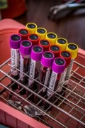 Probówki z próbkami krwi do analizy laboratoryjnej.webp