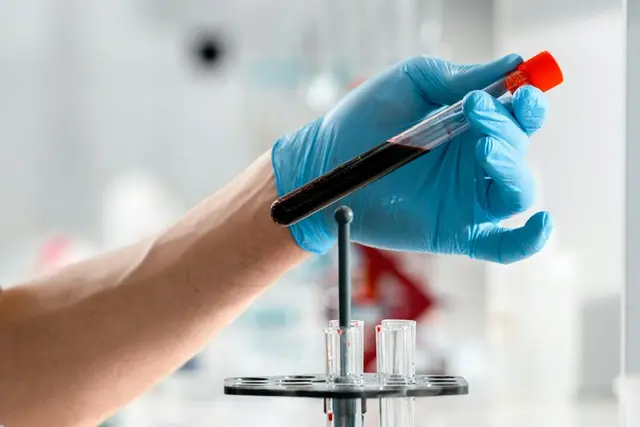 Analizator laboratoryjny Synevo badanie krwi.webp